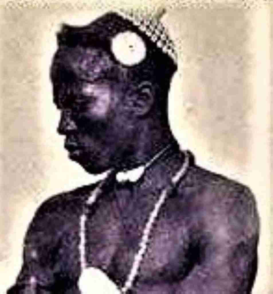 Escaras faciales en Senegal