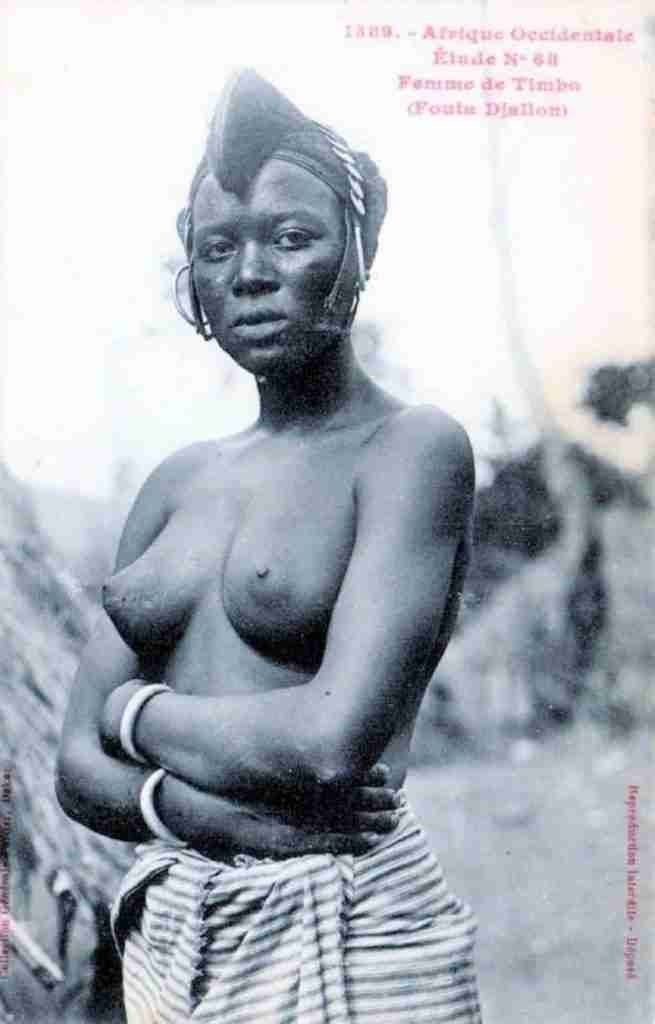 Escaras faciales en Senegal