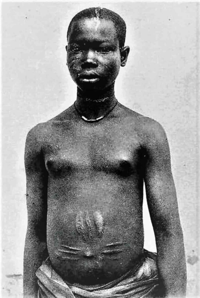 Escarificación en Benin